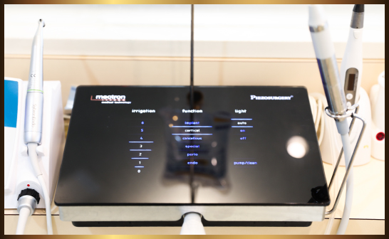 イメージ：ピエゾサージェリー